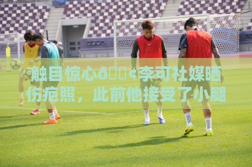 触目惊心😢李可社媒晒伤疤照,此前他接受了小腿血管搭桥手术 触目惊心😢李可社媒晒伤疤照,此前他接受了小腿血管搭桥手术